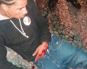 Candidato a deputado é baleado enquanto fazia panfletagem em Curitiba