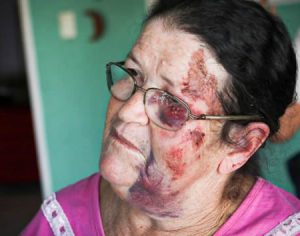 Polícia busca por empresário que arrastou vendedora de balões com o carro