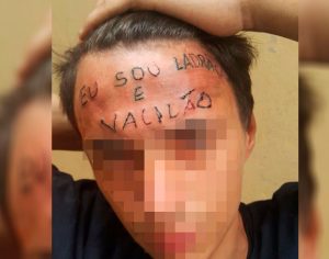 Jovem que teve testa tatuada é batizado em igreja evangélica