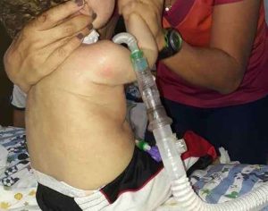 Morre bebê que teve dinheiro de tratamento desviado pelo pai
