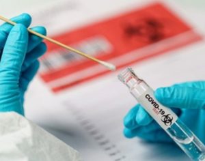 Prefeitura de Londrina adquire mais testes para diagnóstico de covid-19