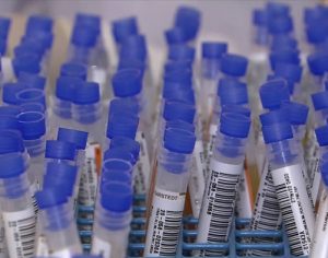 Prefeitura pretende realizar mil testes de coronavírus por semana em Londrina