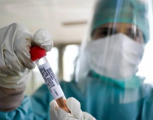 Londrina fez 867 testes de covid-19; número representa 0,15% da população