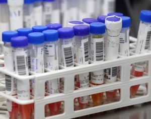 Londrina tem 294 casos ativos de covid, recorde até agora; total é 997