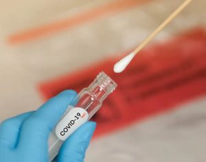 Paciente recebe resultado de teste covid que estava ‘perdido’ em Londrina