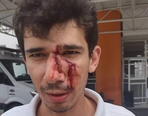 Funcionário é agredido com skate após pedir para cliente usar máscara no PR; VÍDEO