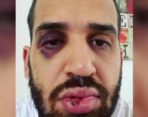 Médico é agredido após alertar sobre risco da pandemia no Paraná