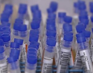 Casos positivos de covid em Londrina triplicam em 24h; 329 estão ativos