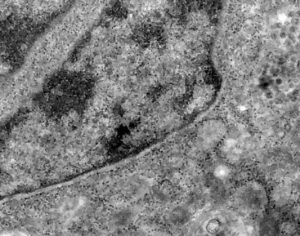 Covid-19: o que se sabe até agora da variante ômicron
