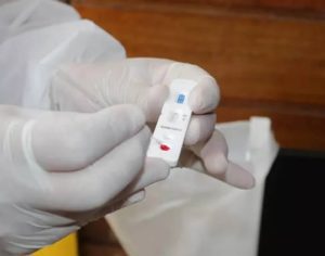 Casos de covid registram alta de quase 850% em Londrina; veja os dados